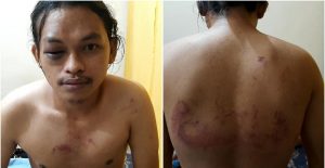 KBM Gelar Demo Protes Tindakan Brutal Polisi ke Mahasiswa Saat Demo Randi-Yusuf