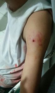Satu Mahasiswa Unidayan Tertembak Saat Demo UU Omnibus Law, Berikut Kronologinya !