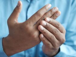 8 Cara Menurunkan Kadar Asam Urat secara Alami Tanpa Obat