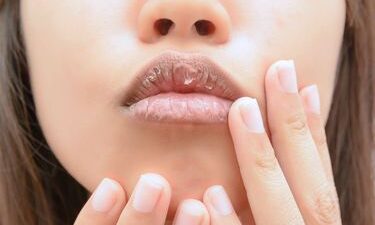 Penyebab Bibir Kering dan Cara Mengatasinya