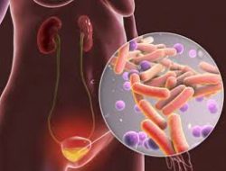 Tanda-tanda Saluran Kemih Tidak Sehat karena Infeksi