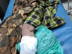 Waspada Teror Busur di Kendari, Emak-Emak Jadi Korban Kena Tusuk di Lutut