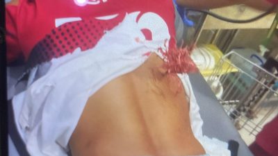 Petugas Lapas Kendari Jadi Korban Teror Busur, Polisi Buru Pelaku