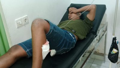Naas! Betis Pemuda ini Jadi Sasaran Mata Busur OTK di Depan RS Tiara Sentosa
