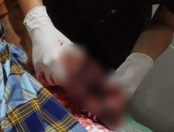 Security BMKG di Kendari Jadi Korban Ledakan Petasan Rakitan Saat Rayakan Malam Pergantian Tahun 2023