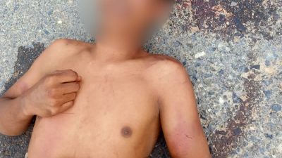 Polisi Selidiki Identitas Pria Tergeletak di Tengah Jalan Abeli Dalam