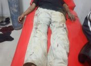 Mahasiswa di Kendari Ditebas OTK di BTN Bumi Praja Anduonohu, Polisi Masih Selidiki Pelakunya