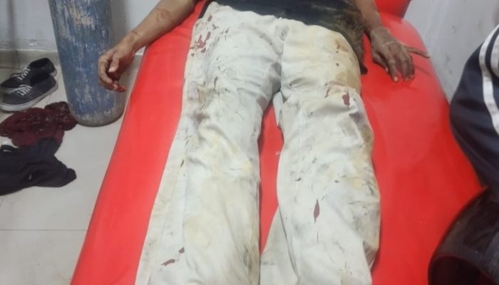 Mahasiswa di Kendari Ditebas OTK di BTN Bumi Praja Anduonohu, Polisi Masih Selidiki Pelakunya