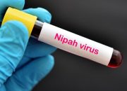 Waspadai Penyakit Virus Nipah, Kemenkes Keluarkan Surat Edaran