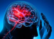 Waspadai Lonjakan Kasus Stroke di Usia Muda, Ternyata Ini yang Jadi Pemicunya