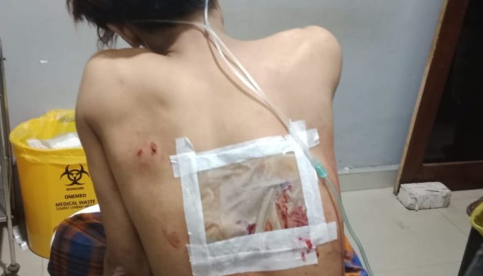 Polisi Selidiki Kawanan Remaja yang Serang Karyawan RM Ayam Taliwang Pakai Sajam