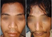 Dua Pelaku Penganiayaan di Penginapan Lawata Diboyong Polisi Ke Polsek Mandonga