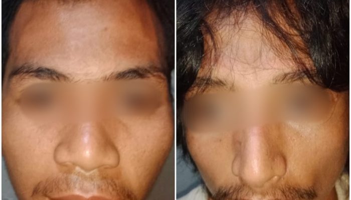 Dua Pelaku Penganiayaan di Penginapan Lawata Diboyong Polisi Ke Polsek Mandonga