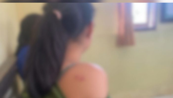 Siswi SMPN 22 Konsel Dianiaya di Sekolahnya, Keluarga Lapor ke Polsek Mowila