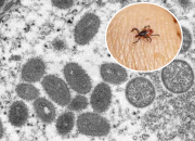 Geger Virus Baru di China Picu Gangguan Saraf, Pakar Singgung Potensi Masuk RI
