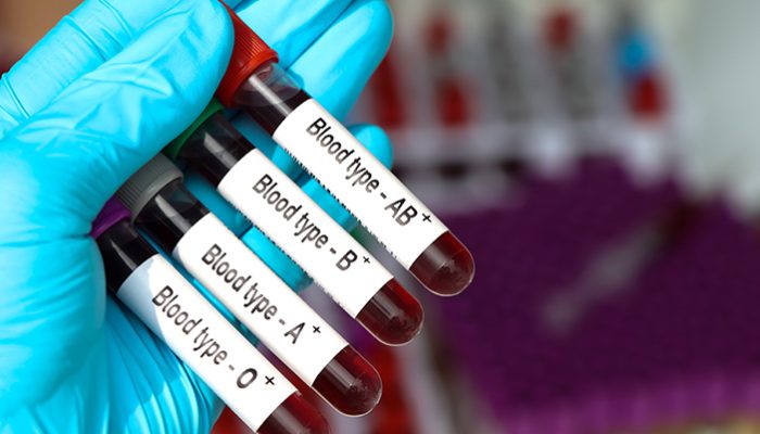 Waspada, Golongan Darah Ini Paling Berisiko Kena Stroke Usia Muda