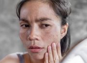 6 Ciri-Ciri Wajah Terkena Merkuri yang Harus Diwaspadai