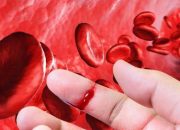 Ada Ribuan Pasien Hemofilia Indonesia yang Diduga Belum Terdeteksi