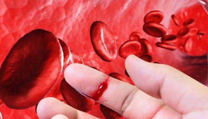 Ada Ribuan Pasien Hemofilia Indonesia yang Diduga Belum Terdeteksi