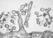 Kenali Gejala Awal Virus Hanta yang Mulai Muncul di Bandung