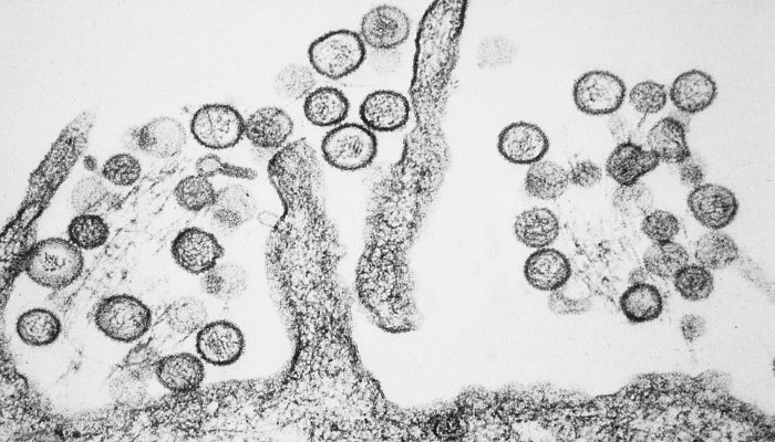 Kenali Gejala Awal Virus Hanta yang Mulai Muncul di Bandung
