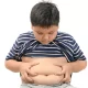 Obesitas ,Anak,