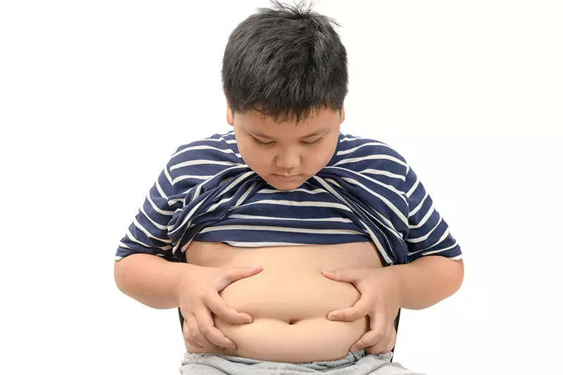 Obesitas ,Anak,