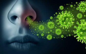 Influenza A