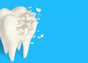 8 Makanan yang Paling Cepat Bikin Gigi Keropos dan Berlubang