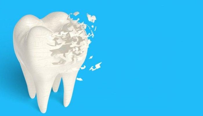 8 Makanan yang Paling Cepat Bikin Gigi Keropos dan Berlubang