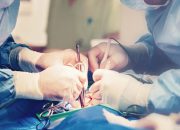 5 Operasi Tidak Ditanggung BPJS Kesehatan, Cek Dulu Sebelum Berobat