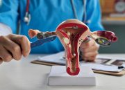 Cewek Perlu Tahu, Ini Masalah ‘Tersembunyi’ di Rahim yang Bisa Ganggu Kesuburan