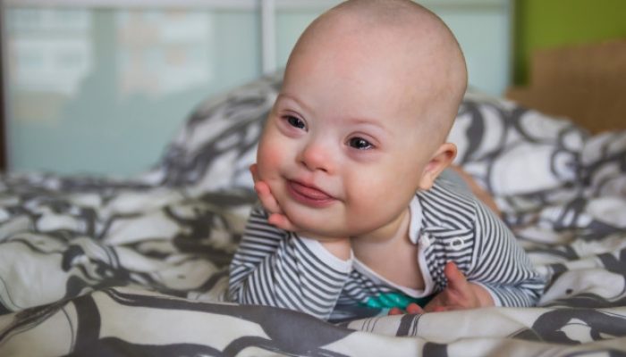 6 Tanda Autisme yang Bisa Dilihat Sejak Bayi, Orang Tua Wajib Simak