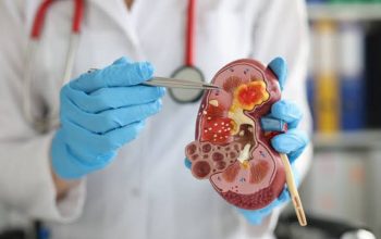 Dokter Wanti-wanti Urine Terlalu Jernih Tak Selalu Sehat, Bisa Jadi Tanda Gangguan Ginjal